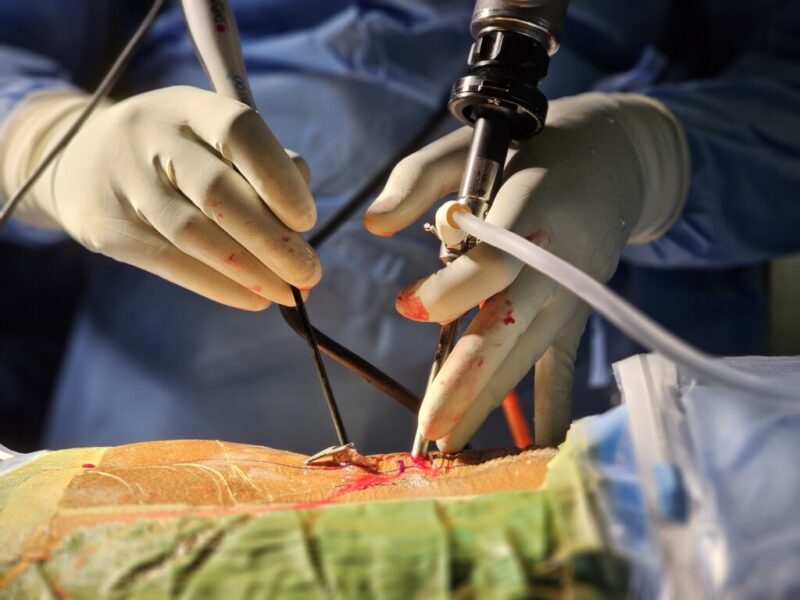 Dr Fazal Rehman -Senior Micro Endoscopic & Robotic Spine Surgeon