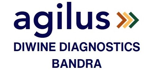 Agilusbandra