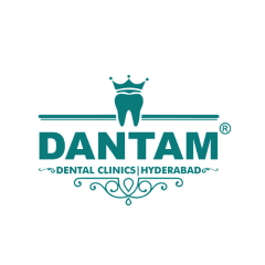 Best Dental Clinic in Kondapur | Dantam Dental Clinic