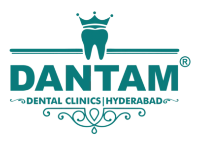 Best Dental Clinic in Kondapur